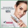 Eucerin DermoPurifyer Triple Effect Serum, 40ml